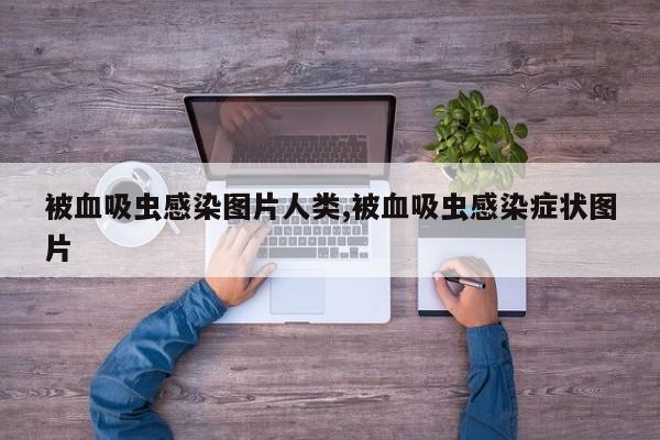 被血吸虫感染图片人类,被血吸虫感染症状图片